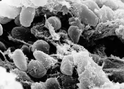California Plague Case Confirmed Near Lake Tahoe | Health Alert Issued
