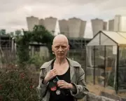 Cancer Survivor Sparks French Movement Against Pesticide Reintroduction