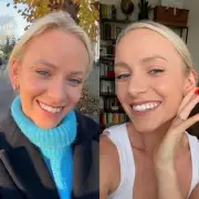 Dentist-Backed Teeth Whitening Kit Slashes 65% Off in Amazon Spring Deal