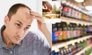 Fizzy Drink Warning: Sugary Sodas & Diet Colas Linked to Alarming Hair Loss Risk, Experts Reveal