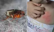 Flea Infestation Crisis: UK Homes Under Siege as Warm Weather Sparks Parasite Plague