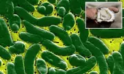 Flesh-Eating Bacteria Outbreak in Louisiana: Two Dead After Consuming Contaminated Seafood | Health Alert