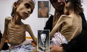 Heartbreaking Images Show Skeletal Palestinian Girl Amid Gaza Food Crisis as Israel Releases Hostage Video