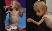 Heartbreaking Images Show Starving Gaza Boy in Tears as Malnutrition Crisis Deepens