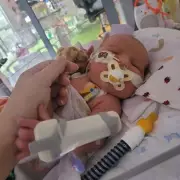 Heartbreaking Story: Baby Born with Fatal Illness Defies the Odds