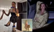 Influencer Breaks Spine Attempting Nicki Minaj TikTok Challenge: A Shocking Warning