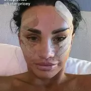Katie Price Unveils Stunning New Look After Cosmetic Surgery – See Her Transformation!