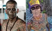 Man With 95% Tattoo Coverage Reveals Agonising Surgery To Remove Them | Daily Mail