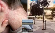 Measles Outbreak Alert: Travellers Returning from Bali Spark Health Fears in Adelaide