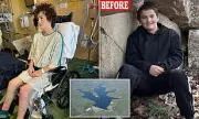 Miracle Survival: Missing Skateboarder Wakes from Coma After Falling into Ravine