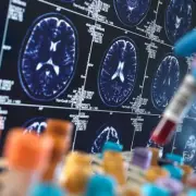 Morning Tea or Coffee Could Slash Diabetes and Dementia Risk, Study Finds