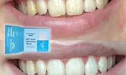 MySweetSmile Peroxide-Free Whitening Strips: A Safe and Effective Way to Brighten Your Teeth