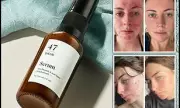 Revolutionary 47 Skin Anti-Blemish & Scar Repair Serum: The Secret to Flawless Skin?
