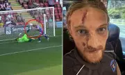 Shocking Moment Footballer Suffers Horror Facial Injury After Being Kicked in the Head