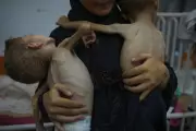Starving Gaza Children Receive Lifesaving NHS Treatment in UK Hospitals