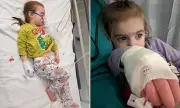 Toddler's Rare Genetic Illness Misdiagnosed as Fever: £500,000 Treatment Could Slow Disease