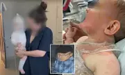 Tragedy in Brisbane: Baby Luka Suffers Severe Burns from Spilled Coffee – Parents Warn of Hidden Dangers