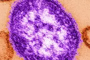 Urgent UK Measles Alert: Cases Soar by 3,000% as Health Chiefs Declare 'National Incident'