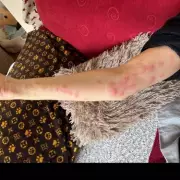 Urgent Warning After Woman Picks Up 'Harmless' Plant – The Shocking Truth Revealed!