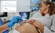 US Health Crisis: 53 Million Americans' Lifestyle Choices Linked to Rise in Birth Defects, Experts Warn