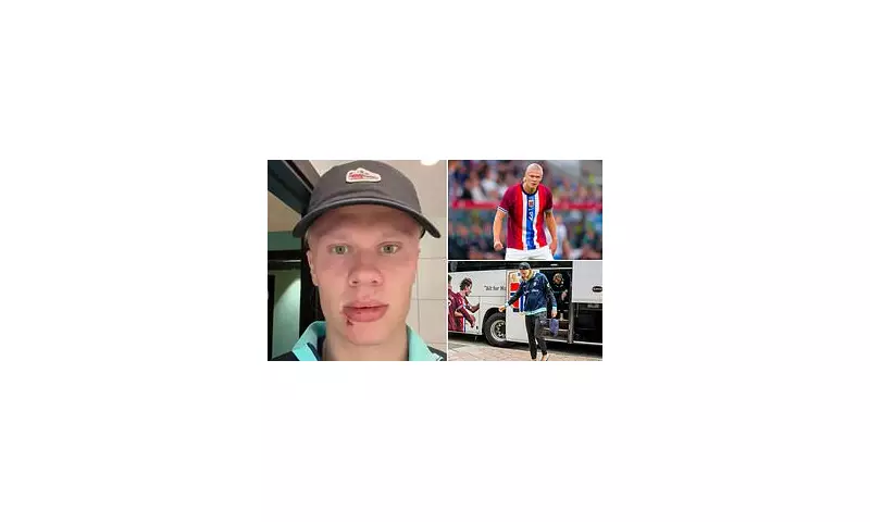 Erling Haaland Injury Shock: Man City Star Needs Stitches After Norway Team Bus Freak Accident