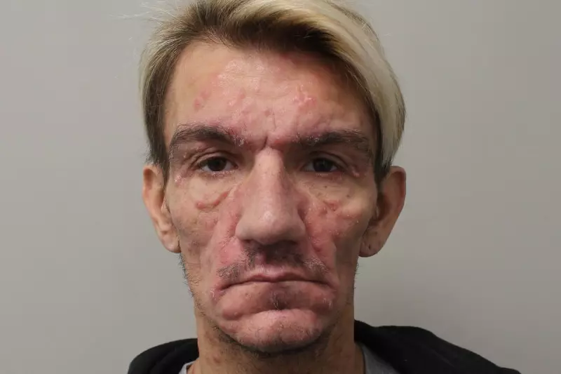 Hornchurch Predator Jailed for 21 Years: Jonathan Carl's Reign of Terror with STI-Infected Needles