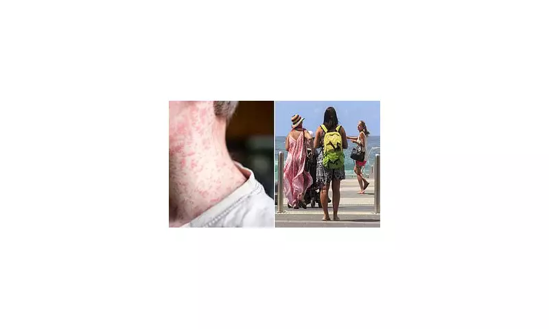 Measles Alert: Gold Coast and Bali Travellers Urged to Monitor Symptoms After Infected Tourist Visit