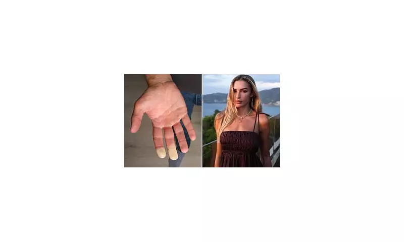 Medical Breakthrough: New Ray of Hope for Raynaud's Sufferers as Doctors Discover Revolutionary Treatment | UK Health News