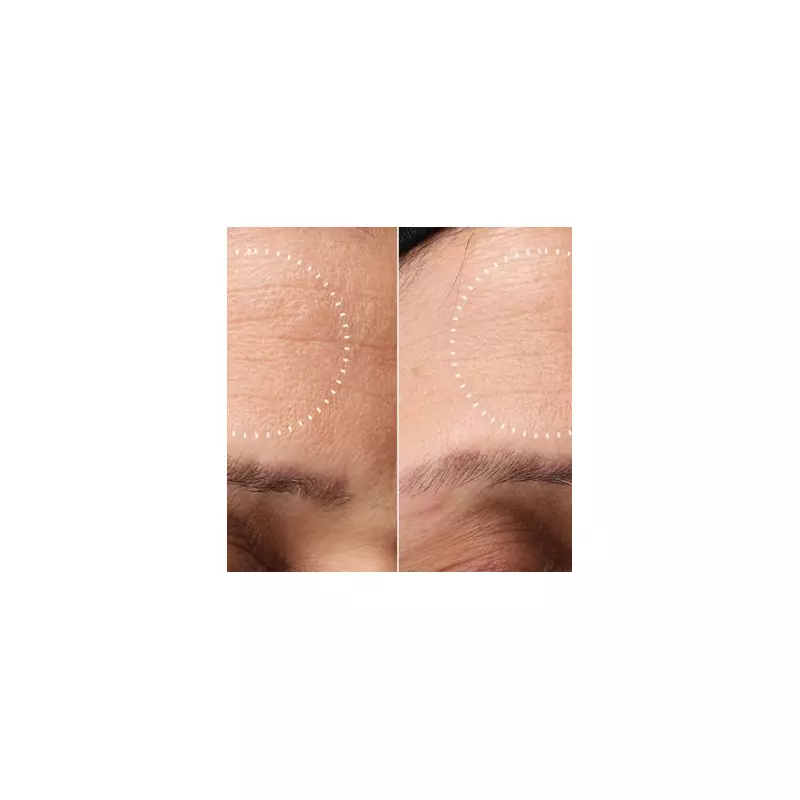 Medik8's At-Home Chemical Peel Kit Slashed by 50% in Unmissable Skincare Deal