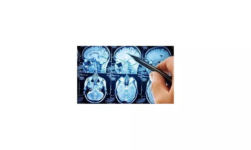 Mental Health Crisis Fuels Dementia Timebomb: Shocking New Study Reveals 50% Higher Risk
