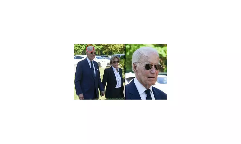 President Biden's Head Scar: Medical Experts Analyse Mohs Surgery Aftermath | Daily Mail