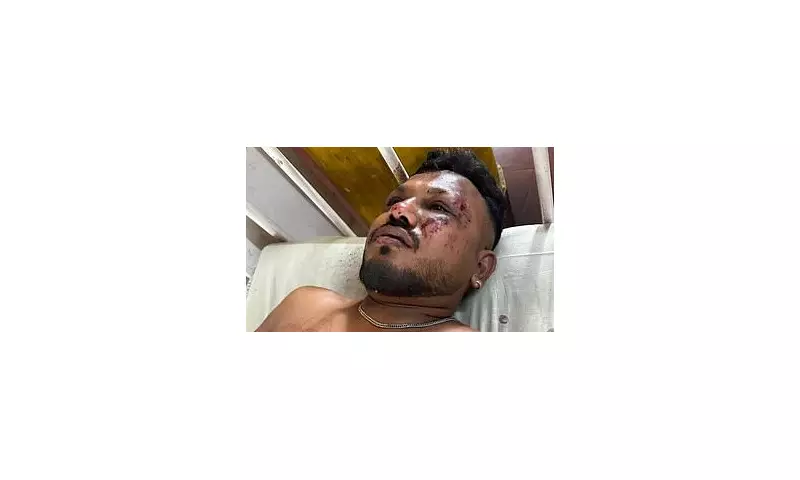Sole British Survivor of Air India Express Crash Vows Never to Fly Again After Kerala Horror