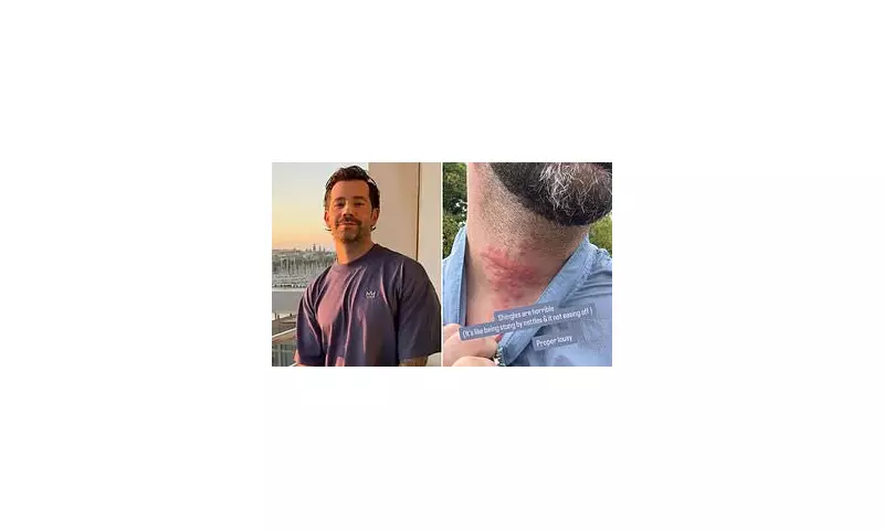 TOWIE Star Charlie King's Shingles Nightmare: Stress-Induced Virus Leaves Reality Star in Agony
