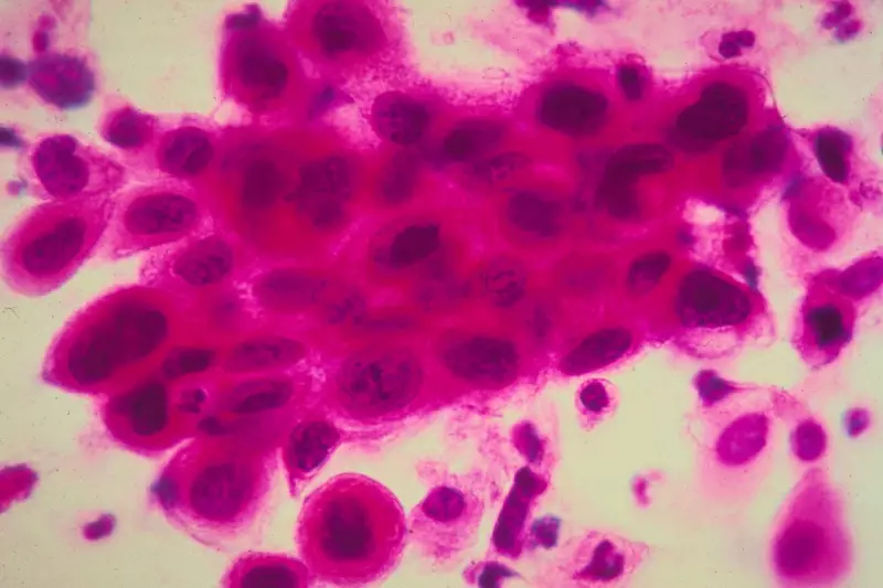 Urgent NHS Cancer Alert: Treatment Pause for Thousands in England Over Safety Fears