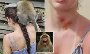 Bali Monkey Attack: Australian Tourist Faces Agonising Rabies Vaccine Ordeal After Vicious Primate Assault