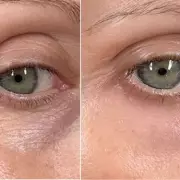 Banish Dark Circles For Less: This £10 Eye Cream Is A Game-Changer