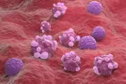 Breakthrough Blood Test for Ovarian Cancer Could Save Thousands of Lives on NHS