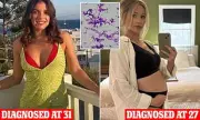 Breakthrough Study Links Common Bacteria to Deadly Pregnancy Complication and Cancer Risk