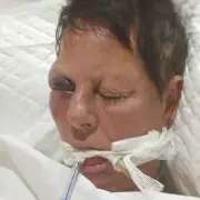 Brit Tourist Fights For Life After Horror Moped Crash In Magaluf