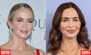 Did Emily Blunt Undergo a Secret Facelift? Top Surgeons Analyse Her 'Strikingly Different' Appearance