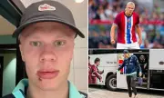 Erling Haaland Injury Shock: Man City Star Needs Stitches After Norway Team Bus Freak Accident