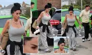 Katie Price's Drastic New Look: Extreme Weight Loss and Painful Eye Injury Revealed During Kerry Katona's Tour