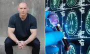 Longevity Expert's Dementia Diagnosis: The Daily Habits That Could Save Your Brain