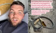 Love Island's Sam Gowland in Bali Nightmare: Rushed to Hospital After Venomous Snake Bite