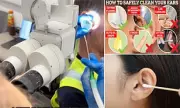 NHS Issues Urgent Warning: The Hidden Dangers of At-Home Ear Wax Removal Kits Revealed