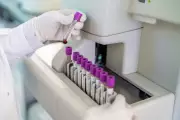 NHS to Roll Out Groundbreaking Blood Test for Ovarian Cancer That Could Save Thousands of Lives