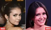 Nina Dobrev Opens Up About Cosmetic Procedures: 'I'm Not Going to Lie About It' | Exclusive