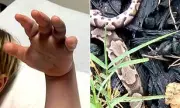 Outrage as Nursery Staff 'Fail to Call 999' After Four-Year-Old Boy Bitten by Snake in UK Daycare