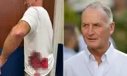 Rampaging Stag Attack: Grandfather, 67, Left with Broken Ribs in Terrifying Deer Park Ordeal