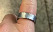 Samsung Galaxy Ring Nightmare: UK Wearer Hospitalised After Severe Skin Reaction